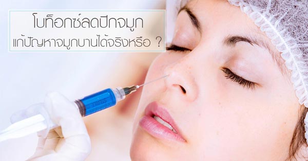 โบท็อกซ์ลดปีกจมูก โบท็อกซ์ลดปีกจมูก