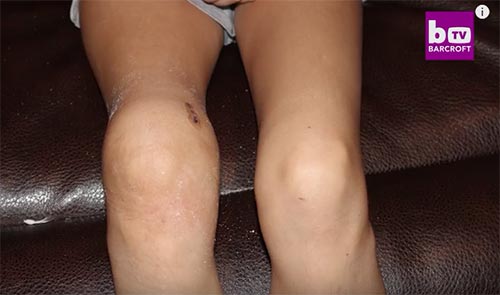 โรคมะเร็ง โรคมะเร็ง