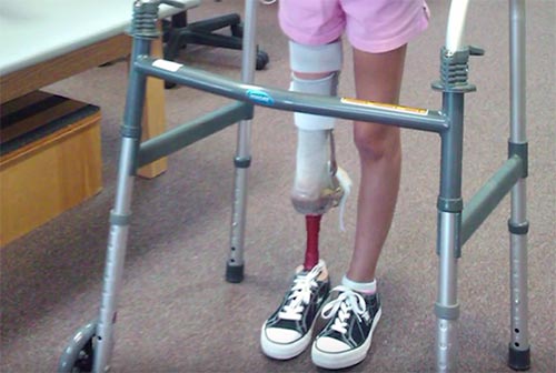 โรคมะเร็ง โรคมะเร็ง