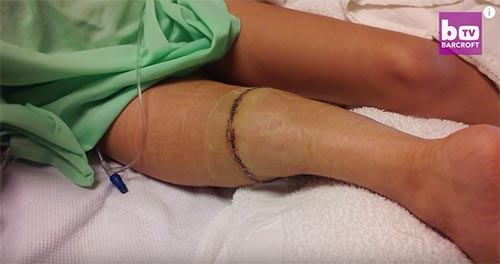 โรคมะเร็ง โรคมะเร็ง