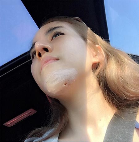 น้ำส้ม โซมี่ ศัลยกรรม น้ำส้ม โซมี่ ศัลยกรรม