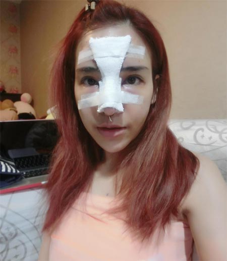 น้ำส้ม โซมี่ ศัลยกรรม น้ำส้ม โซมี่ ศัลยกรรม