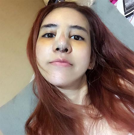 น้ำส้ม โซมี่ ศัลยกรรม น้ำส้ม โซมี่ ศัลยกรรม