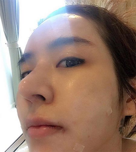 น้ำส้ม โซมี่ ศัลยกรรม น้ำส้ม โซมี่ ศัลยกรรม