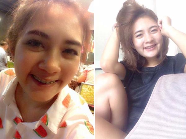 สูตรอาหารลดน้ำหนัก สูตรอาหารลดน้ำหนัก