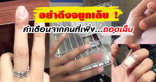 อย่าดึงจมูกเล็บ อย่าดึงจมูกเล็บ