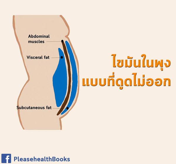 ไขมันในช่องท้อง ไขมันในช่องท้อง