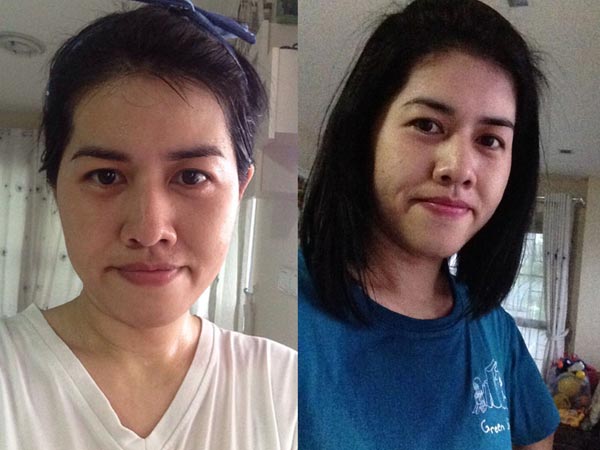 แชร์ประสบการณ์ลดน้ำหนัก แชร์ประสบการณ์ลดน้ำหนัก