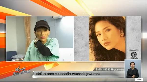 อังคณา ทิมดี อังคณา ทิมดี