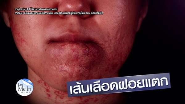 เหวิน พิชญ์พนิต Let Me In Thailand เหวิน พิชญ์พนิต Let Me In Thailand