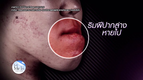 เหวิน พิชญ์พนิต Let Me In Thailand เหวิน พิชญ์พนิต Let Me In Thailand