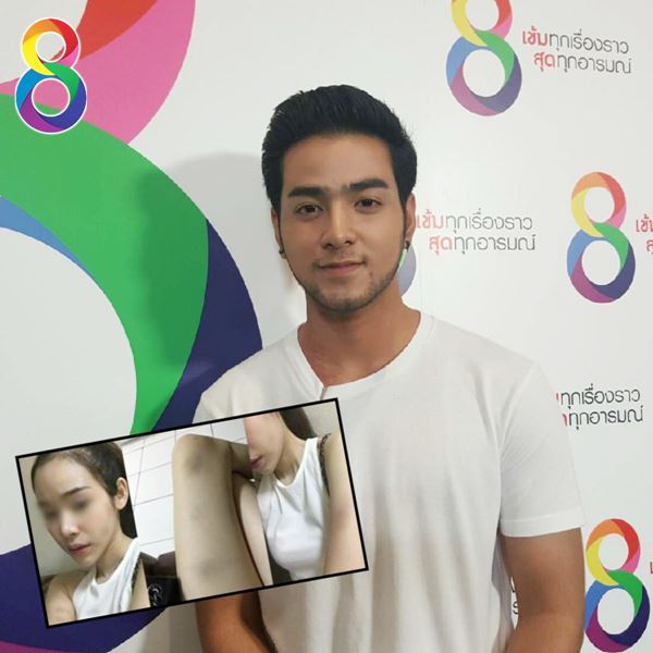 โตส อัครัช โตส อัครัช