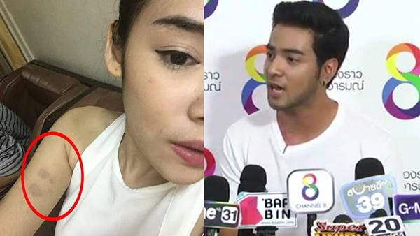 โตส อัครัช โตส อัครัช