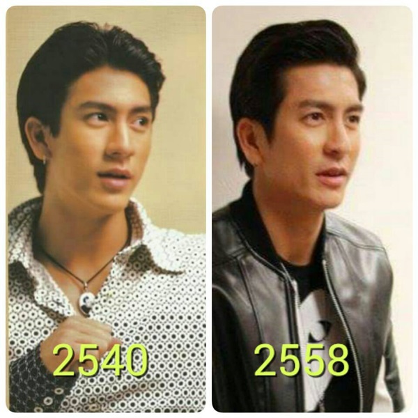 ติ๊ก เจษฎาภรณ์ ทรงผม