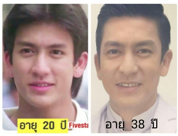 ติ๊ก เจษฎาภรณ์ ทรงผม