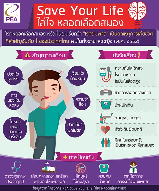โรคหลอดเลือดสมอง โรคหลอดเลือดสมอง