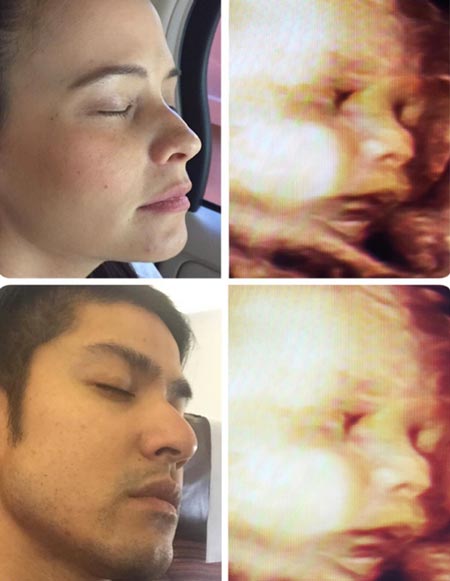 แอน อลิชา ท้อง แอน อลิชา ท้อง