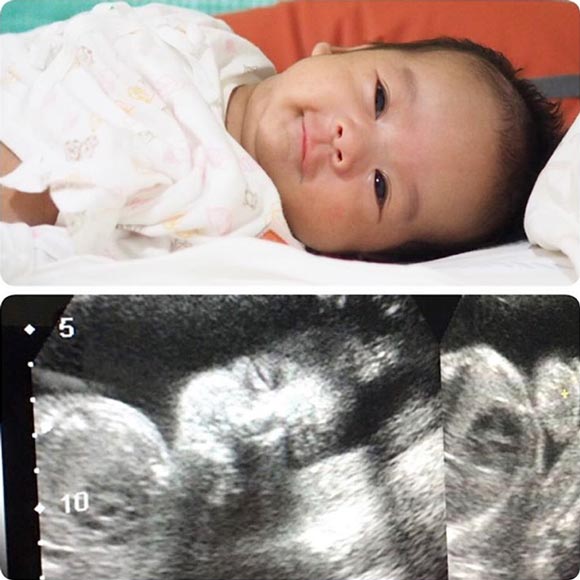น้องวิน ลูกชาย เอ๊าะ กีรติ น้องวิน ลูกชาย เอ๊าะ กีรติ