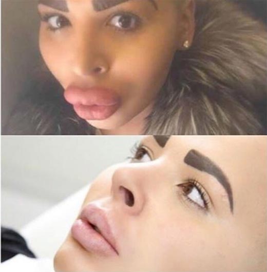 จอร์แดน เจมส์ ปาร์ก ศัลยกรรมหน้าเหมือน คิม คาร์ดาเชียน จอร์แดน เจมส์ ปาร์ก ศัลยกรรมหน้าเหมือน คิม คาร์ดาเชียน