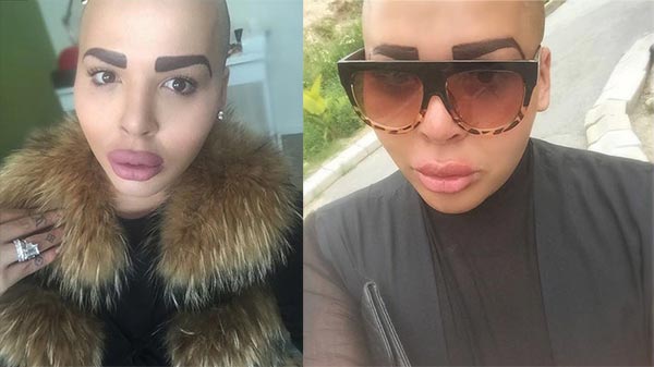 จอร์แดน เจมส์ ปาร์ก ศัลยกรรมหน้าเหมือน คิม คาร์ดาเชียน จอร์แดน เจมส์ ปาร์ก ศัลยกรรมหน้าเหมือน คิม คาร์ดาเชียน