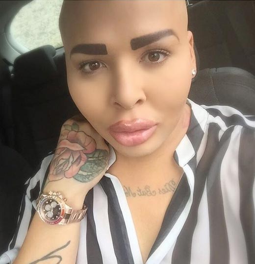 จอร์แดน เจมส์ ปาร์ก ศัลยกรรมหน้าเหมือน คิม คาร์ดาเชียน จอร์แดน เจมส์ ปาร์ก ศัลยกรรมหน้าเหมือน คิม คาร์ดาเชียน