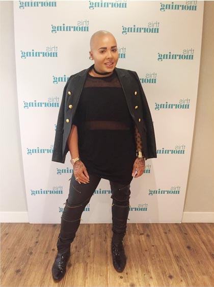 จอร์แดน เจมส์ ปาร์ก ศัลยกรรมหน้าเหมือน คิม คาร์ดาเชียน จอร์แดน เจมส์ ปาร์ก ศัลยกรรมหน้าเหมือน คิม คาร์ดาเชียน