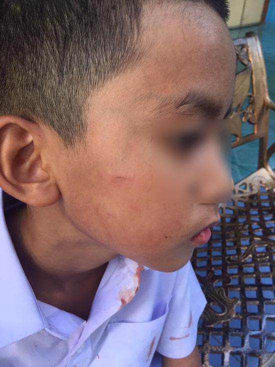 ครูตีนักเรียน ครูตีนักเรียน