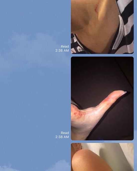 ดาราวัยรุ่นจากซีรีส์ดัง ซ้อมแฟนสาว ดาราวัยรุ่นจากซีรีส์ดัง ซ้อมแฟนสาว