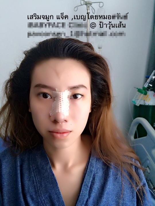 แจ็ค เบญ แจ็ค เบญ