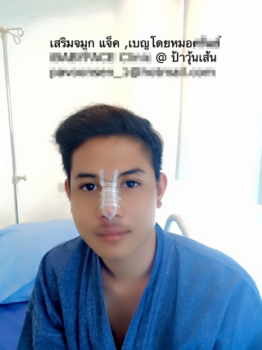 แจ็ค เบญ แจ็ค เบญ