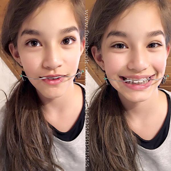 น้องนาทัชชา น้องนาทัชชา