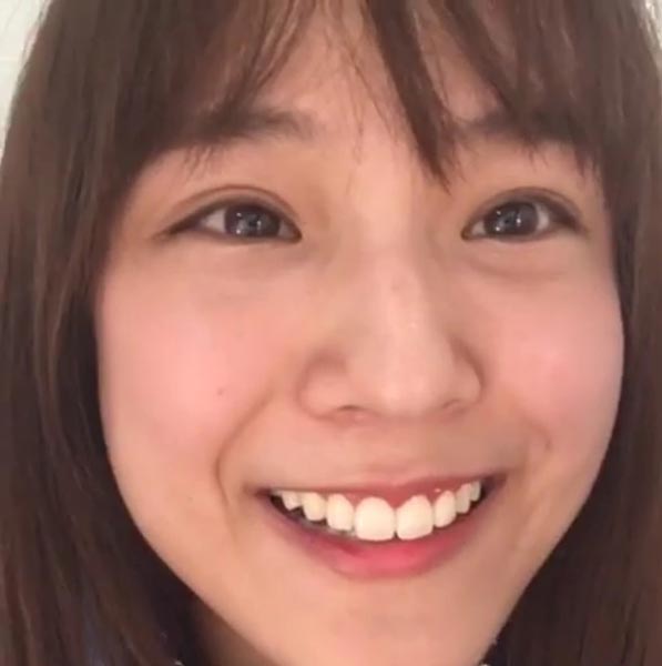 แพทตี้ อังศุมาลิน แพทตี้ อังศุมาลิน