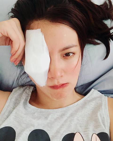 อันตรายที่คาดไม่ถึง ! ใบเฟิร์น ถูกที่คาดผมดีดตาดำ ขณะเล่นฟิตเนส อันตรายที่คาดไม่ถึง ! ใบเฟิร์น ถูกที่คาดผมดีดตาดำ ขณะเล่นฟิตเนส