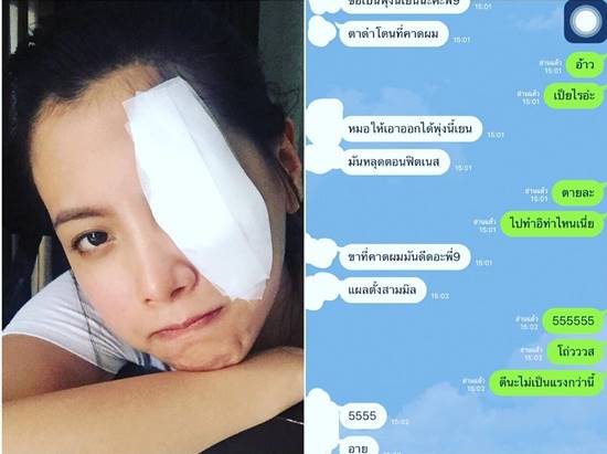 อันตรายที่คาดไม่ถึง ! ใบเฟิร์น ถูกที่คาดผมดีดตาดำ ขณะเล่นฟิตเนส อันตรายที่คาดไม่ถึง ! ใบเฟิร์น ถูกที่คาดผมดีดตาดำ ขณะเล่นฟิตเนส