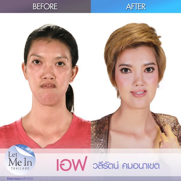 เปิดเรื่องซึ้ง..ของ เอฟ Let Me In Thailand กับสามีคู่ชีวิต ผู้รักเธอโดยไม่มีเงื่อนไข เปิดเรื่องซึ้ง..ของ เอฟ Let Me In Thailand กับสามีคู่ชีวิต ผู้รักเธอโดยไม่มีเงื่อนไข