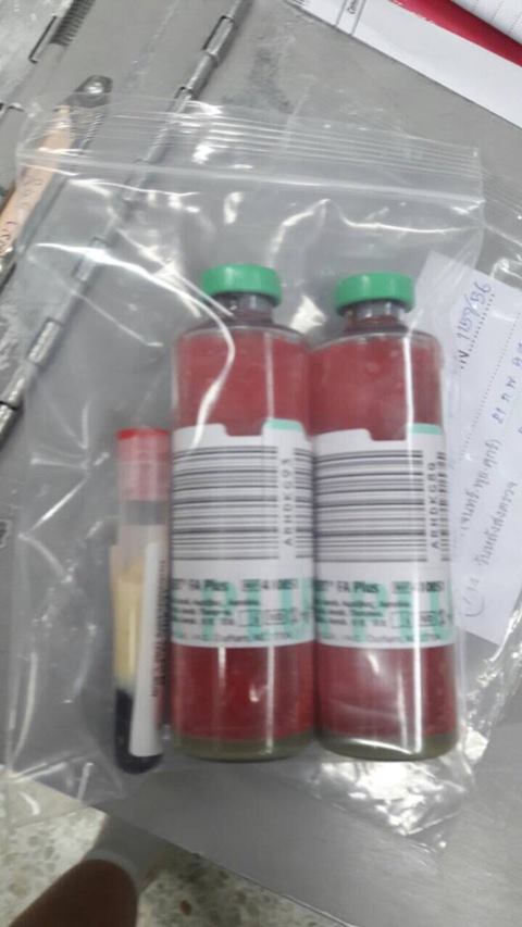 หมออึ้ง ตรวจเจอคนไข้เลือดสีชมพู เพราะยาลดความอ้วน หมออึ้ง ตรวจเจอคนไข้เลือดสีชมพู เพราะยาลดความอ้วน