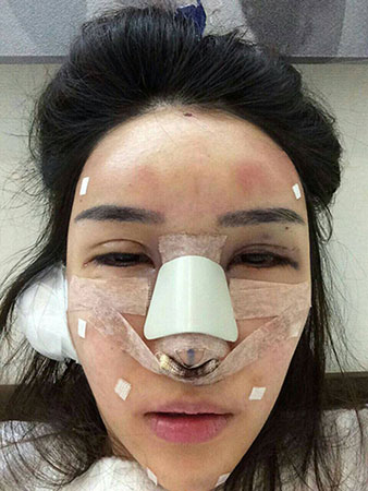 ศัลยกรรมเกาหลี ศัลยกรรมเกาหลี