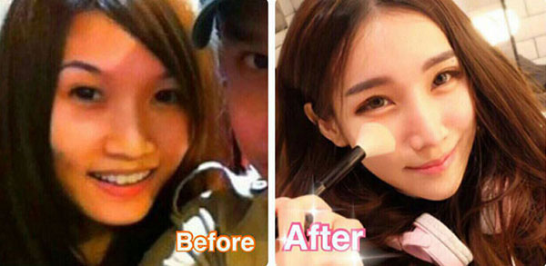 ศัลยกรรมเกาหลี ศัลยกรรมเกาหลี