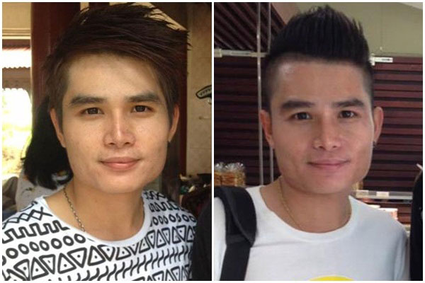 ผู้ชายทําศัลยกรรม ผู้ชายทําศัลยกรรม