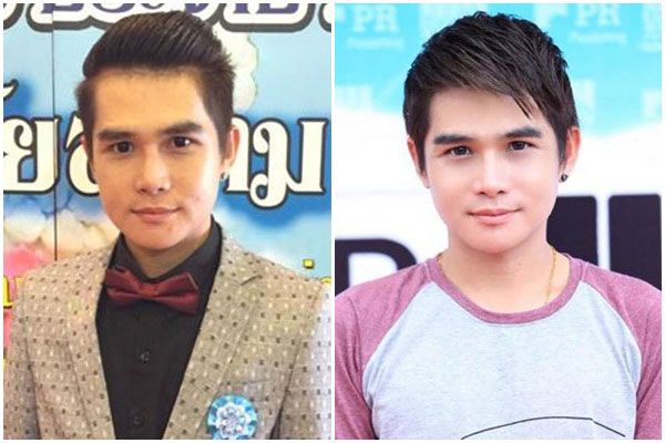 ผู้ชายทําศัลยกรรม ผู้ชายทําศัลยกรรม