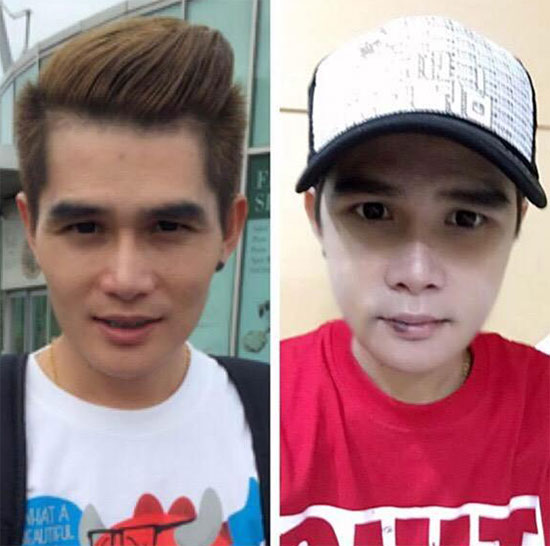 ผู้ชายทําศัลยกรรม ผู้ชายทําศัลยกรรม