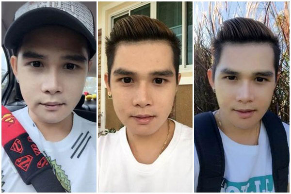 ผู้ชายทําศัลยกรรม ผู้ชายทําศัลยกรรม