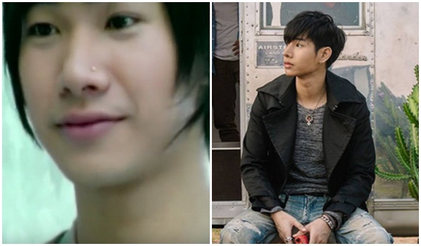 เป๊ก ผลิตโชค ศัลยกรรม เป๊ก ผลิตโชค ศัลยกรรม