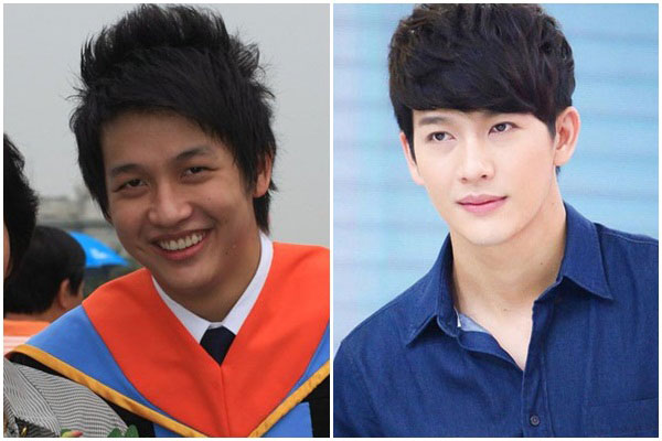 ดาราชายศัลยกรรม ดาราชายศัลยกรรม