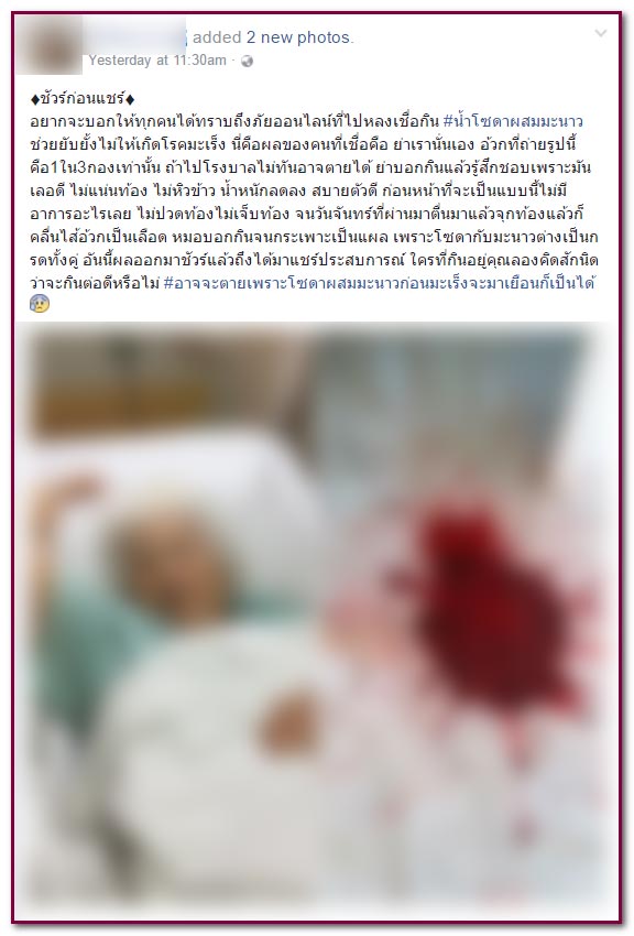 น้ำมะนาว-โซดา รักษามะเร็ง น้ำมะนาว-โซดา รักษามะเร็ง