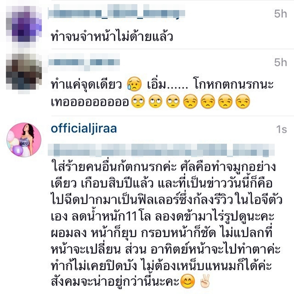 กัสจัง ยอมรับ ทำศัลยกรรมอะไรบ้าง กัสจัง ยอมรับ ทำศัลยกรรมอะไรบ้าง