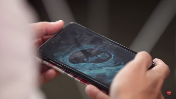 กุ๊บกิ๊บ บี้ kpn กุ๊บกิ๊บ บี้ kpn