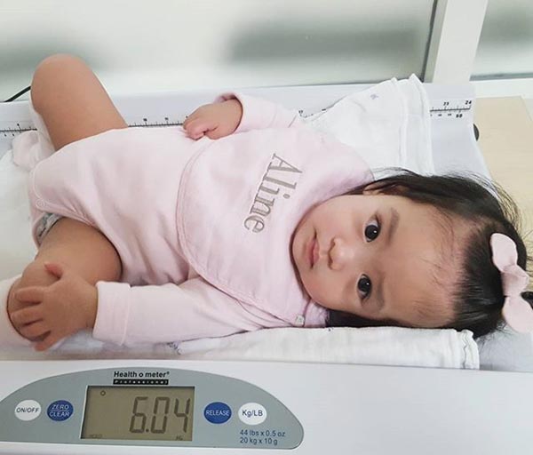 โอปอล์ มั่นใจมือหมอ ไม่หวั่น น้องอลิน ผ่าตัดรักษาลิ้นหัวใจตีบ โอปอล์ มั่นใจมือหมอ ไม่หวั่น น้องอลิน ผ่าตัดรักษาลิ้นหัวใจตีบ