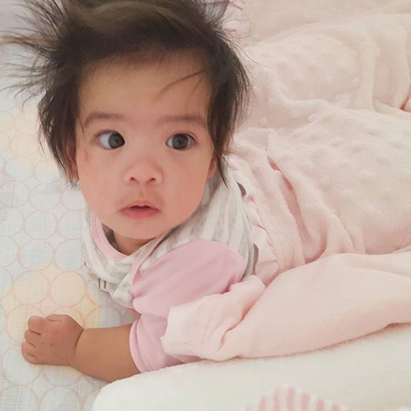 โอปอล์ มั่นใจมือหมอ ไม่หวั่น น้องอลิน ผ่าตัดรักษาลิ้นหัวใจตีบ โอปอล์ มั่นใจมือหมอ ไม่หวั่น น้องอลิน ผ่าตัดรักษาลิ้นหัวใจตีบ