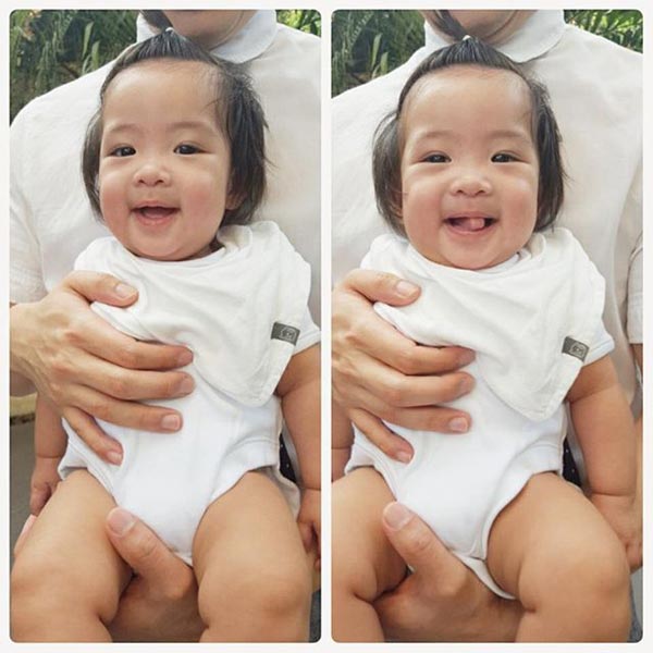 โอปอล์ มั่นใจมือหมอ ไม่หวั่น น้องอลิน ผ่าตัดรักษาลิ้นหัวใจตีบ โอปอล์ มั่นใจมือหมอ ไม่หวั่น น้องอลิน ผ่าตัดรักษาลิ้นหัวใจตีบ